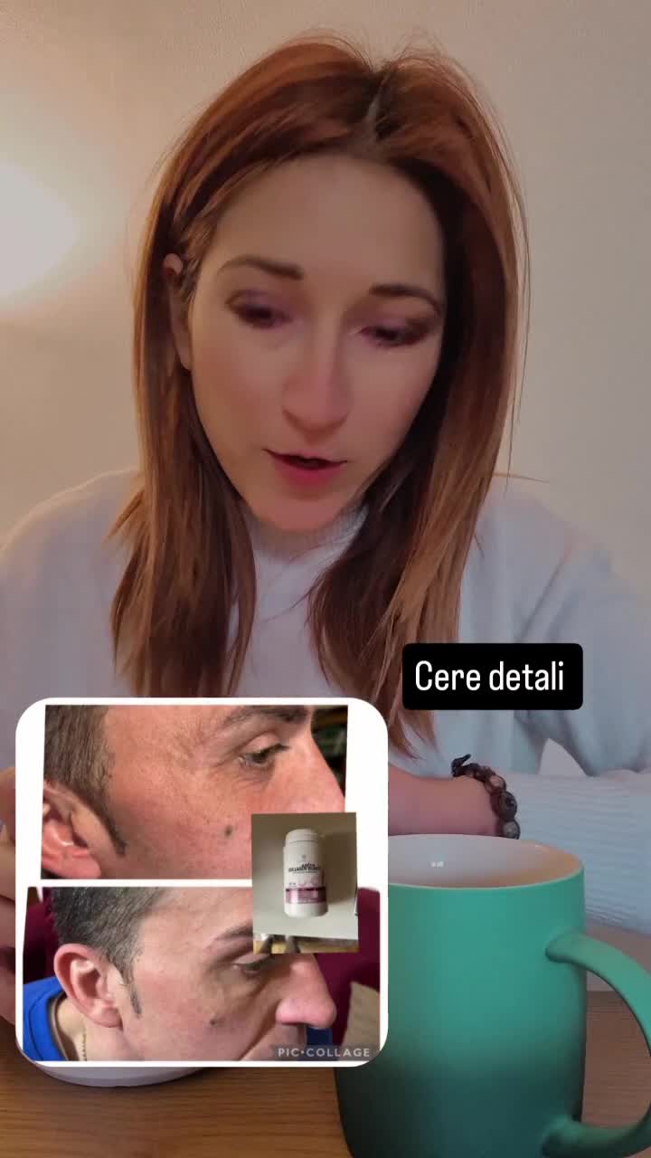 Il collagene è una proteina fondamentale per il nostro corpo, poiché rappresenta circa il 30% delle proteine totali del corpo umano. Ha un ruolo essen