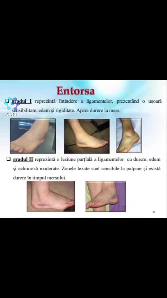 Video de @launermedical