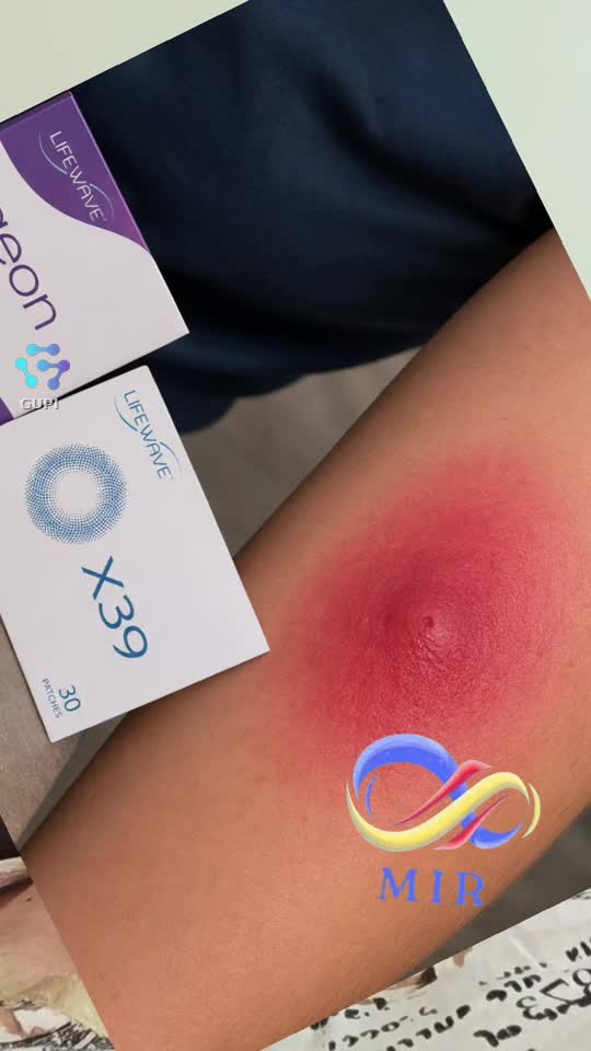 Remedii naturale.fara chimicale aplicăm pe piele în punctele de acupunctură