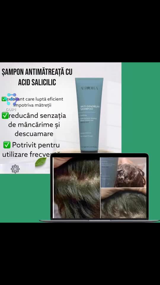 ✨ Scapă de mătreață natural! Acidul salicilic curăță delicat scalpul, lăsând părul proaspăt și luminos. 🌿 Scrie-mi în privat! 💬👇
