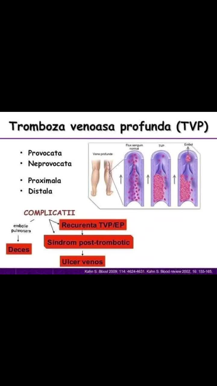 Video de @launermedical