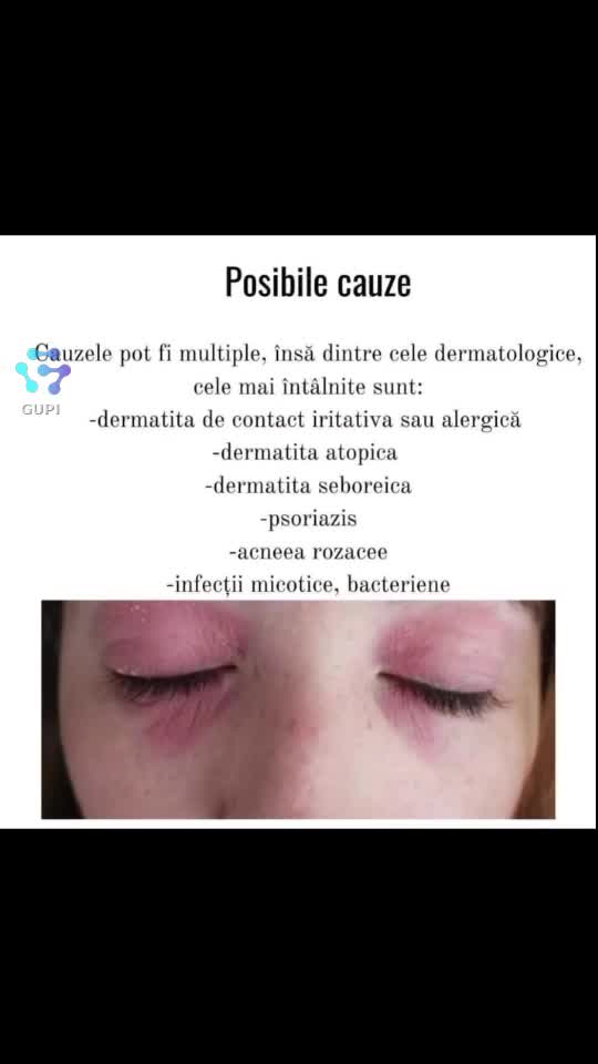 Video de @launermedical